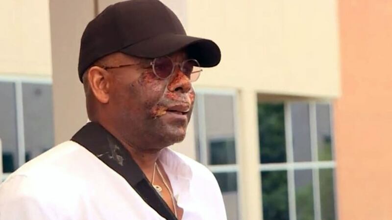 Former Congressman Allen West was injured in an Saturday accident north of Waco. (Staff photo)