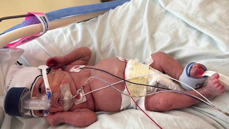 Born at 23 weeks and 6 days, Raelynn Kubiske weighed 12.5 ounces.