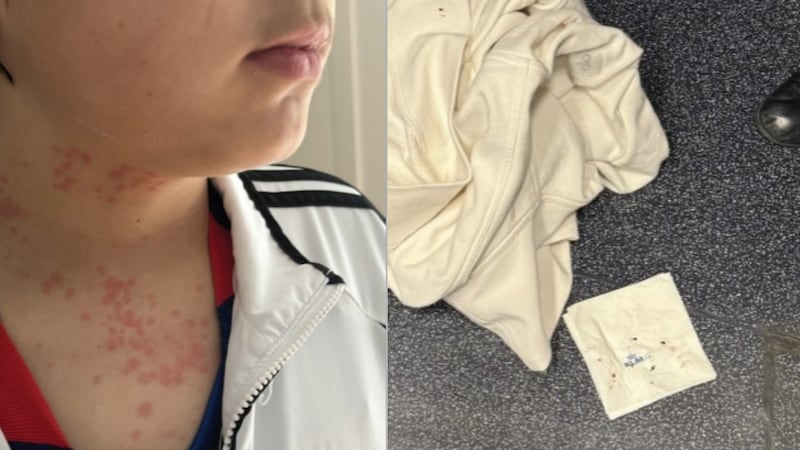 A family in Virginia says they were bitten and injured by bed bugs during a transatlantic...
