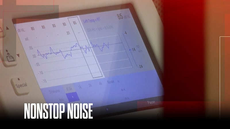 Millions of Americans affected by tinnitus while cause still remains unknown