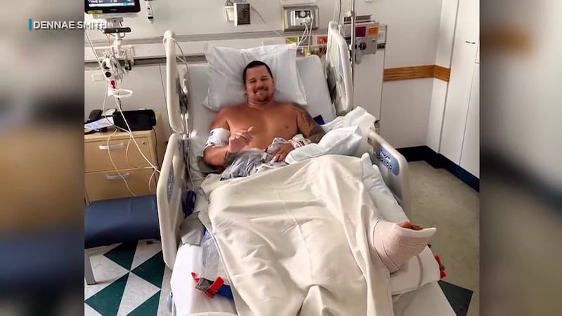 A veteran surfer and father of two suffered serious injuries to both legs when he was bitten...