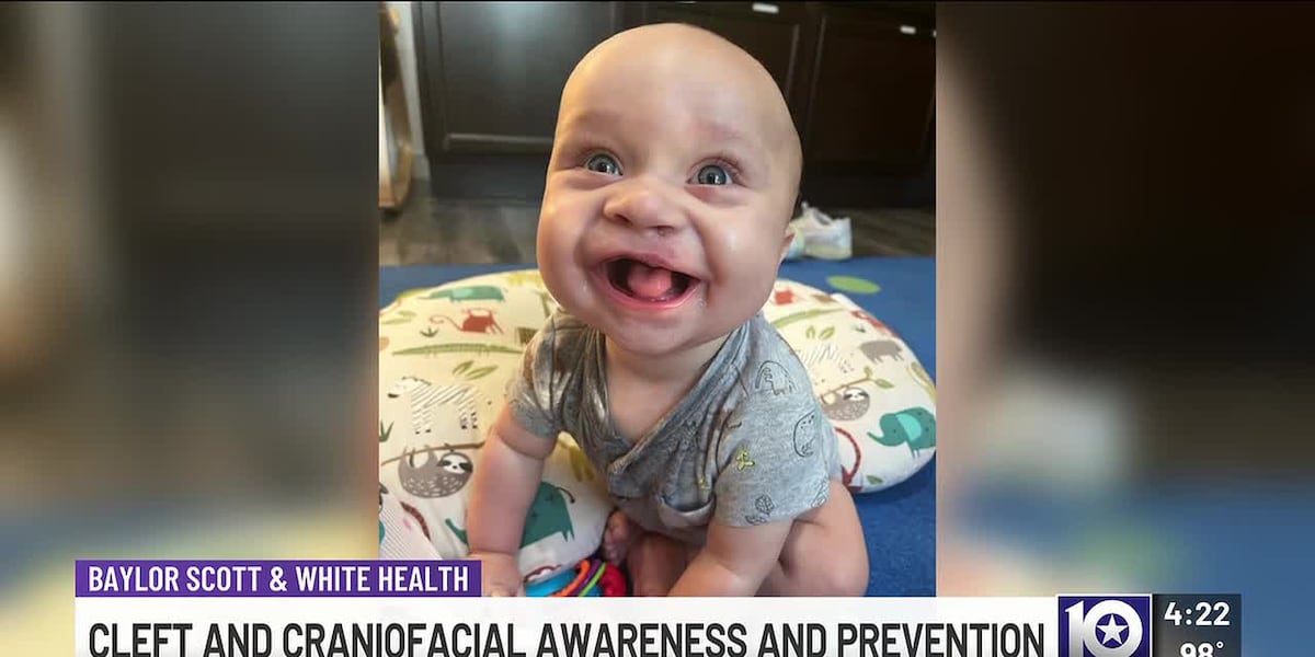 Cleft Lip & Palate: A Mother's Journey and the Hope in Modern Treatment
